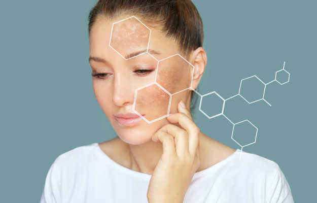 What Are The Causes Of Hyperpigmentation