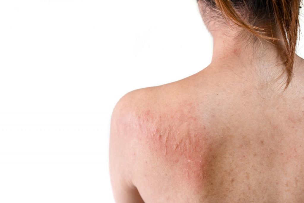 Common Causes of Skin Rashes