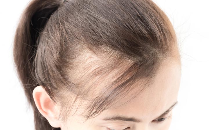 Ways To Grow Forehead Hair